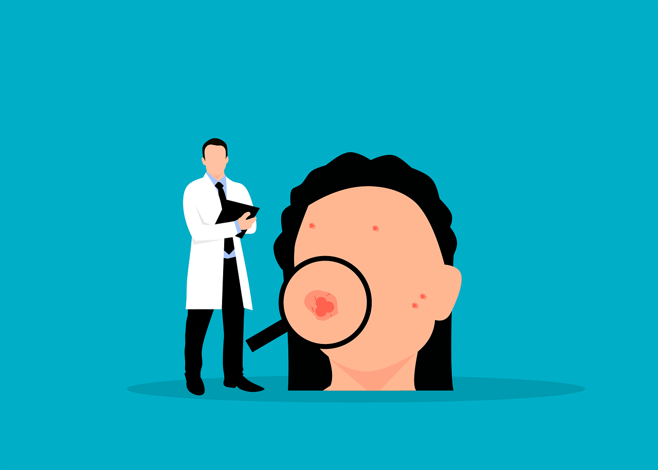 Comment vérifier son immunité contre la varicelle : tests et indications